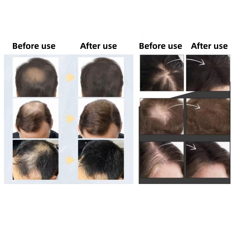 20pcsHair Fiber Keratin Hair B - Hair Care Natural Products review and price