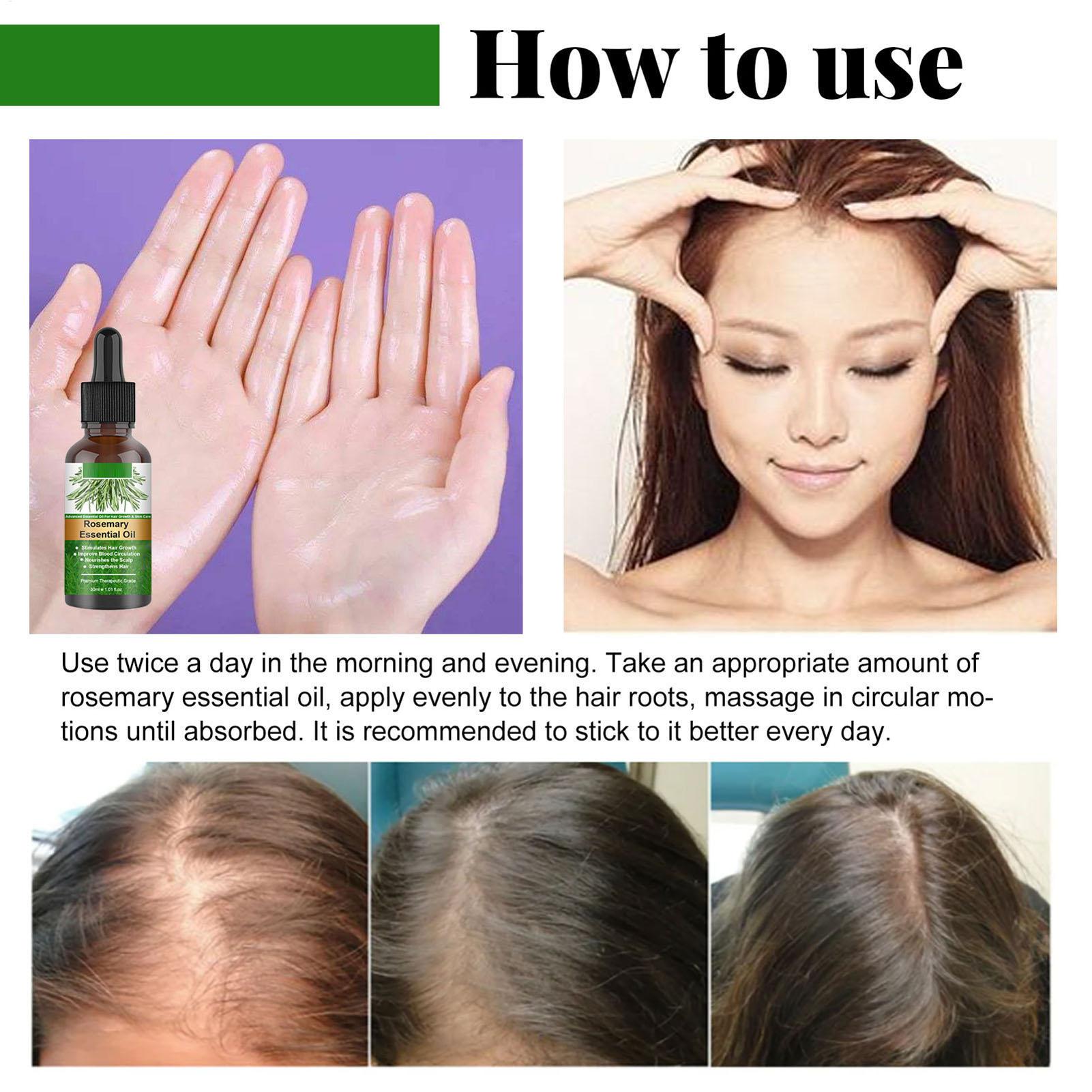 Rosemary Essential Oil Hair Gr - Hair Care Natural Products review and price