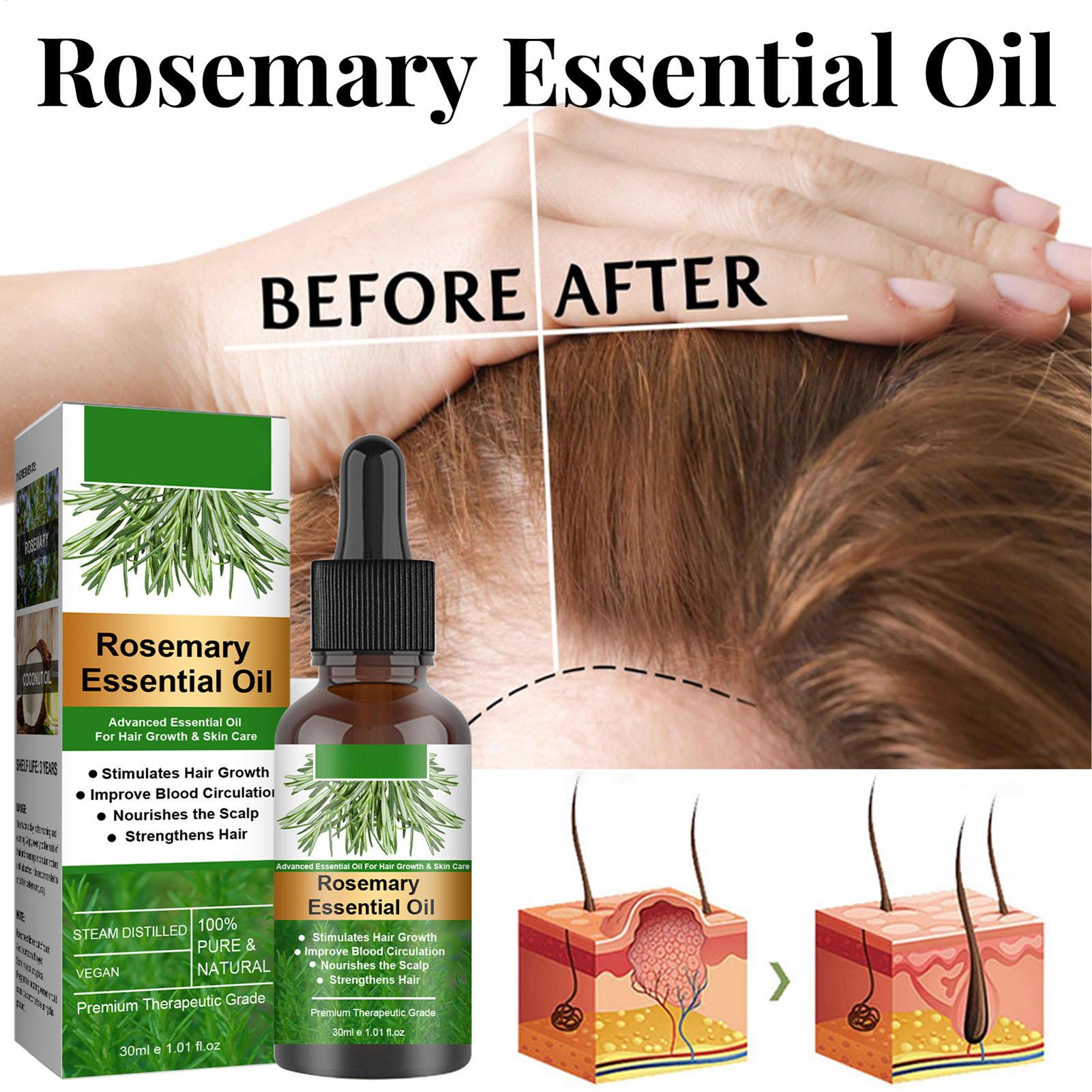 Rosemary Essential Oil Hair Gr - Hair Care Natural Products review and price