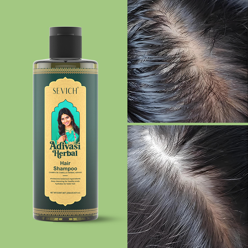 Hair Growth Oil Set Rosemary H - Hair Care India review and price